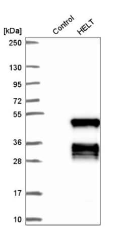 HELT Antibody, Novus Biologicals 25 &mu;L; Unlabeled:Antibodies, Polyclonal